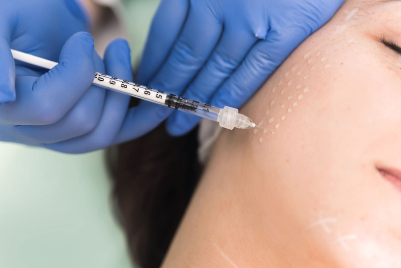 A Mesotherapy Treatment
